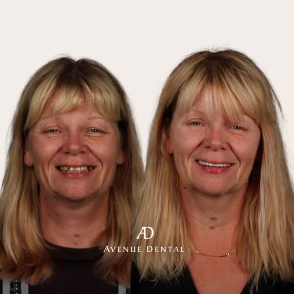 Avenue Dental Dr Sanchit Bhait