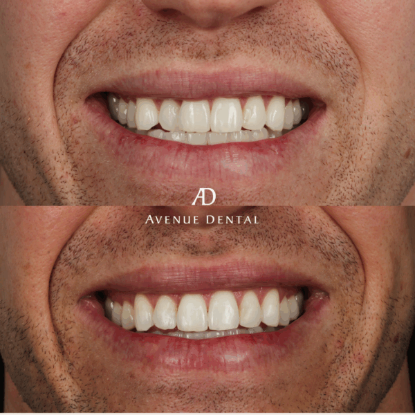 Avenue Dental Dr Angela Chen (1)
