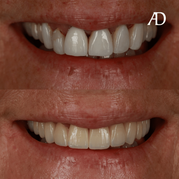 Crowns Avenue Dental Sunshine Coast